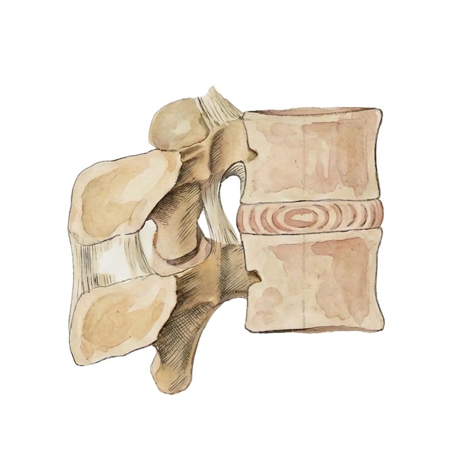 Braus-lumbar-disc-side-view-CEU