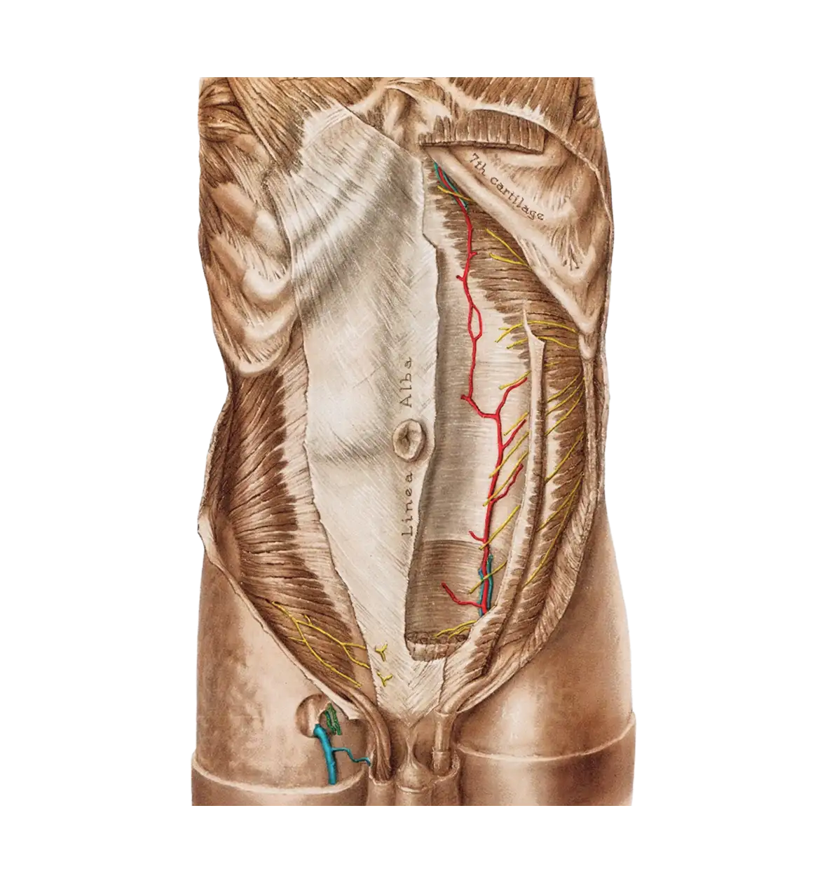 Diastasis Recti