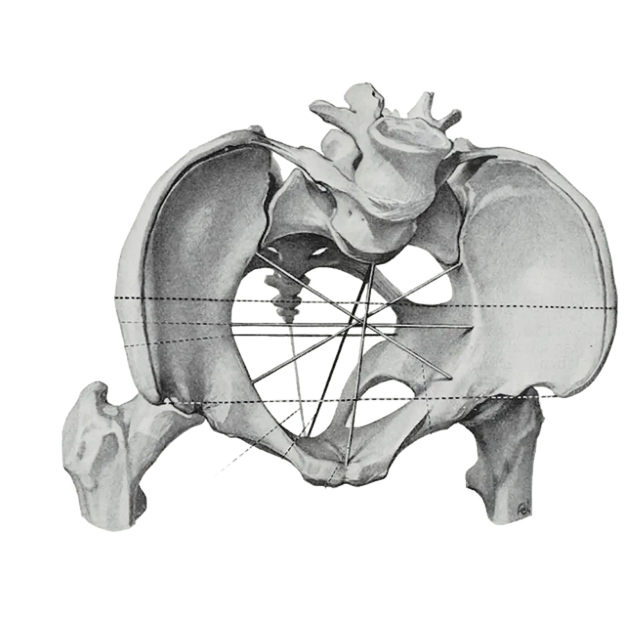 Some of the pelvic dimensions, the internal ones are shown with knitting needles, the external ones - with a bold dotted line