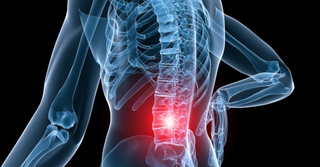 X-ray of spine with highlighted pain