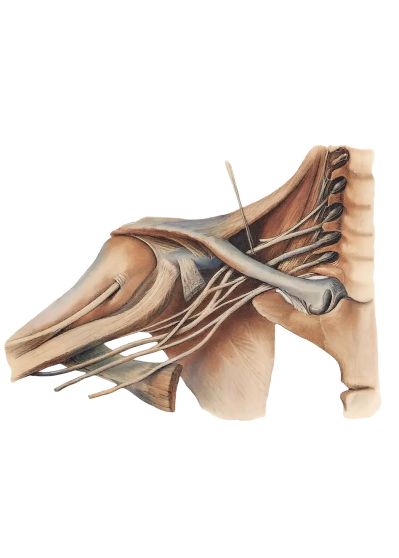 Anatomical illustration of the brachial plexus: nerve roots from the cervical spine passing beneath the clavicle to the arm